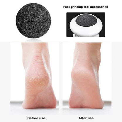 Blossom Beauty Vacuum Callus Remover