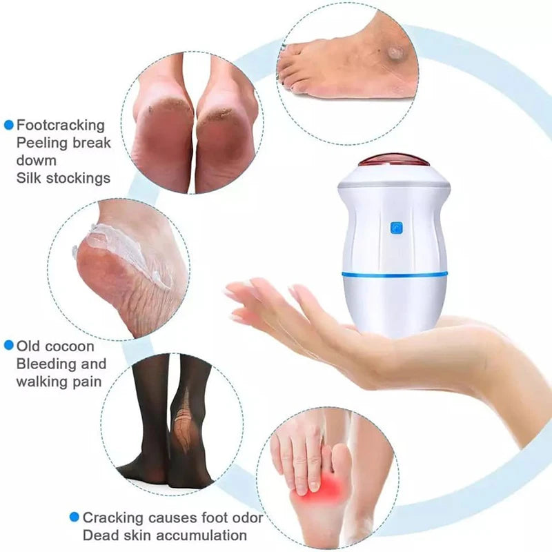 Blossom Beauty Vacuum Callus Remover