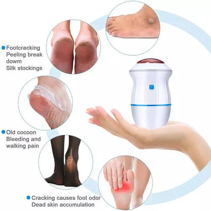 Blossom Beauty Vacuum Callus Remover