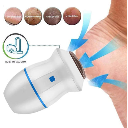 Blossom Beauty Vacuum Callus Remover